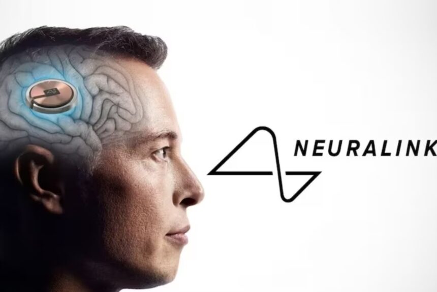 Elon Musk says first Neuralink patient can control a computer mouse through thinking